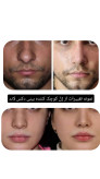 ژل کوچک کننده بینی دکس لاند اصل | تخصصی و حرفه ای