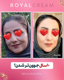 کرم ژل رویال آواطب ۲۰ گرم نمونه اصل بهمراه صابون رویال