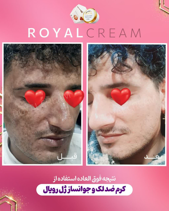 کرم ژل رویال آواطب ۲۰ گرم نمونه اصل بهمراه صابون رویال