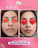 کرم ژل رویال آواطب ۲۰ گرم نمونه اصل بهمراه صابون رویال