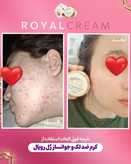 کرم ژل رویال آواطب ۲۰ گرم نمونه اصل